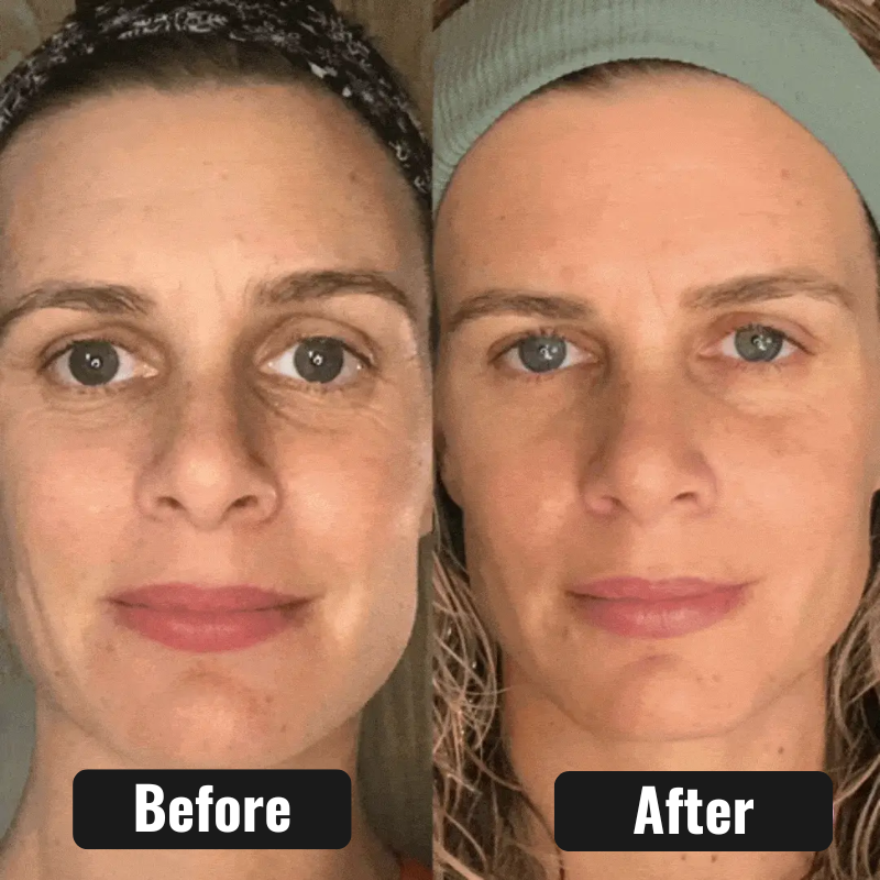 ReSculpt Facial Sculptor™