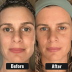 ReSculpt Facial Sculptor™