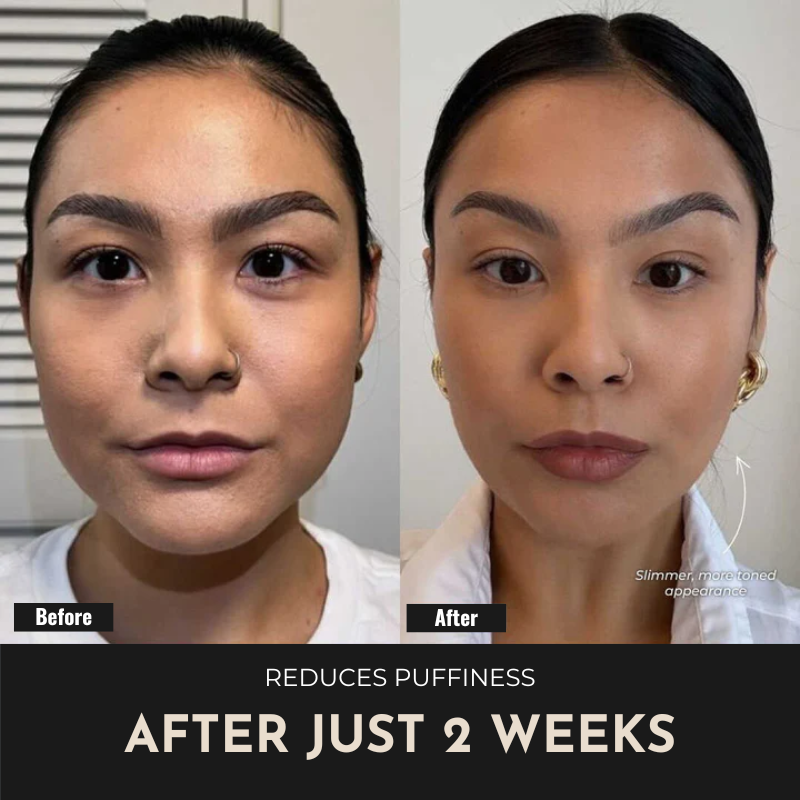 ReSculpt Facial Sculptor™